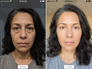 Sandra M., Age 52, 4 weeks