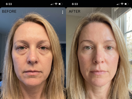 Karen L., Age 47, 6 weeks